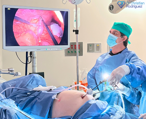 Dr. Christian Rodriguez Duodenal Switch Surgery Mexico