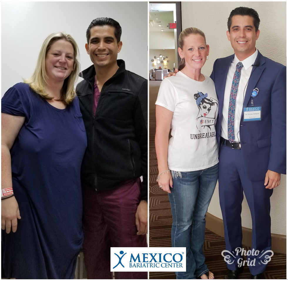 Echo's before and after photos with Dr. Rodriguez - Houston Texas