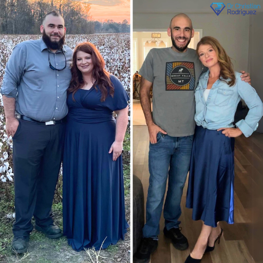 Haley and Andrew Before and After RNY Gastric Bypass