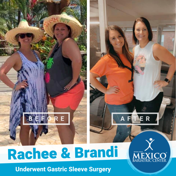 Rachee & Brandi Gastric Sleeve Before and After