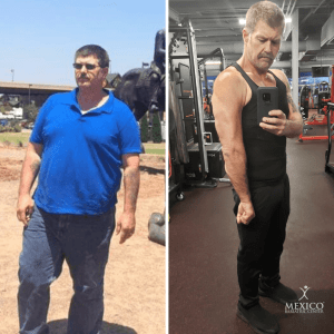 Mark before and after