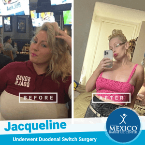 Jacqueline before and after