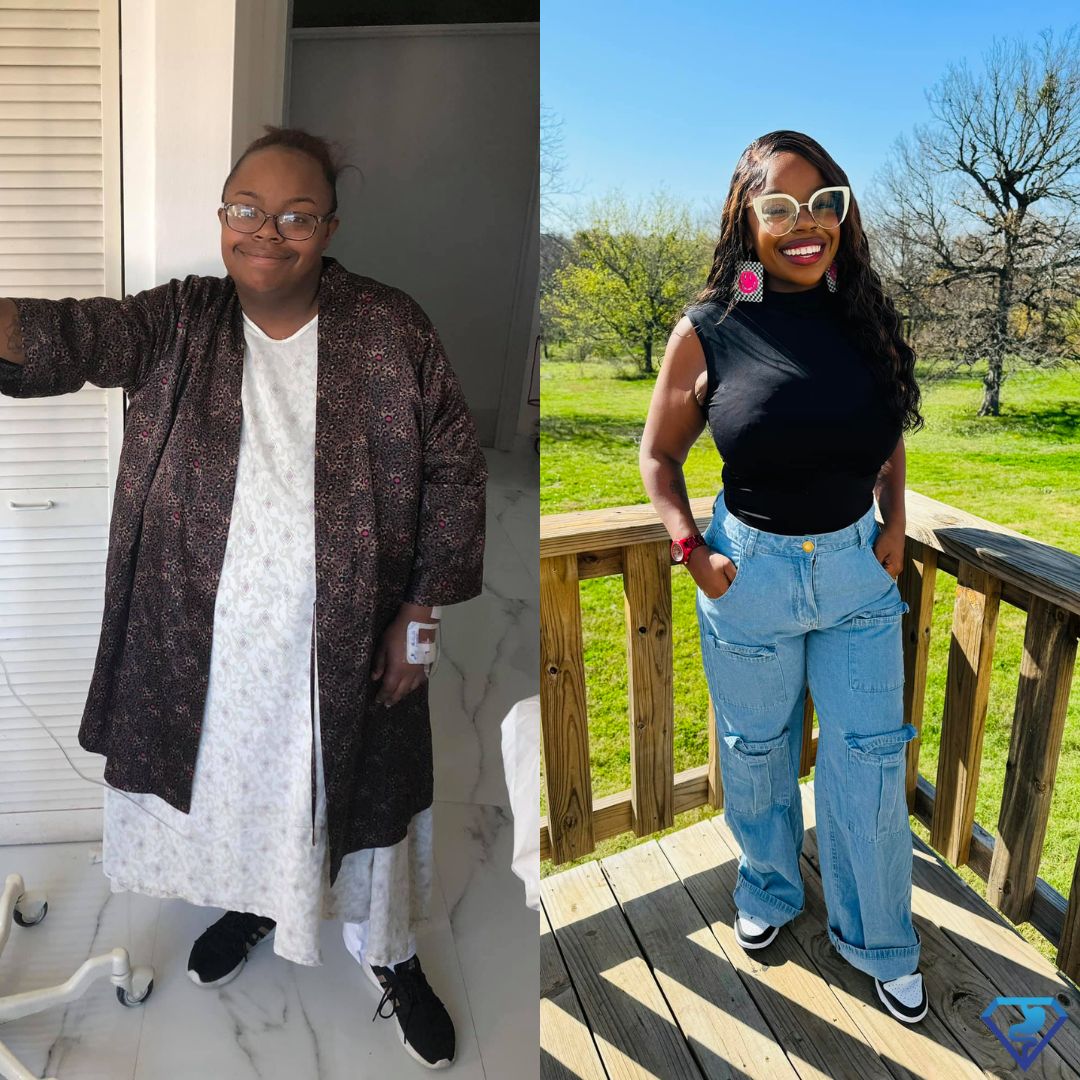 Takiya A Before and After Gastric Sleeve -Dr. Christian Rodriguez